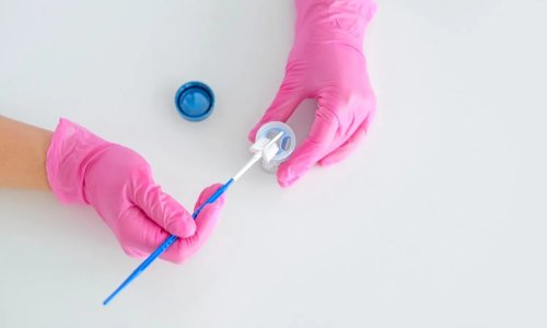pap smear test nədir